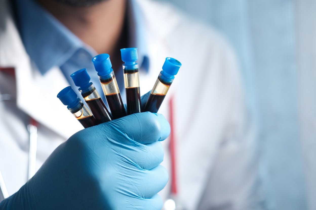 Hand in Blue Medical Gloves Holding Blood Test Tube White Sited